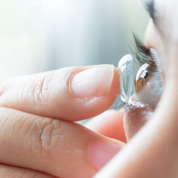 A Brief Overview Of Contact Lenses