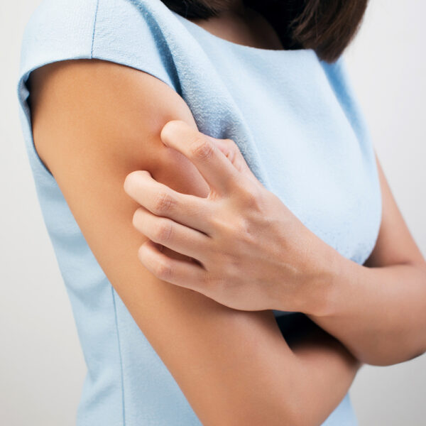 An Overview Of Skin Rashes And Its Treatment